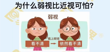 為什么弱視比近視可怕？